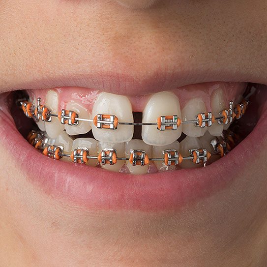 Hilgers Orthodontics -