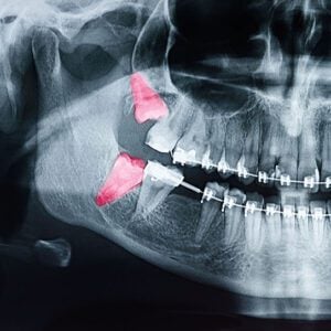 Hilgers Orthodontics -