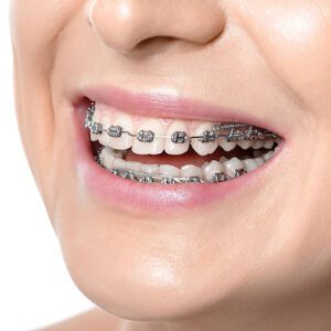 Hilgers Orthodontics -