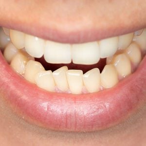Hilgers Orthodontics -