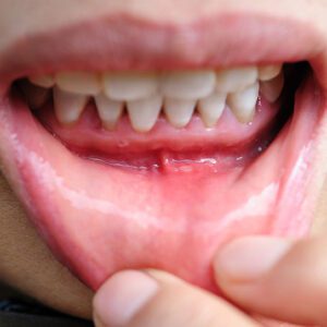 Hilgers Orthodontics -