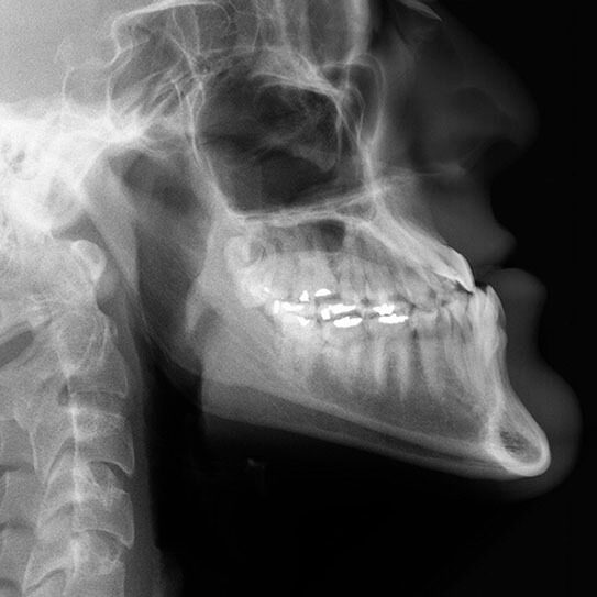 Hilgers Orthodontics -