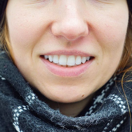Hilgers Orthodontics -