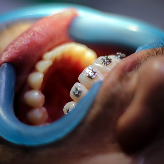 Hilgers Orthodontics -