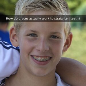 Hilgers Orthodontics -