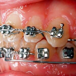 Hilgers Orthodontics -