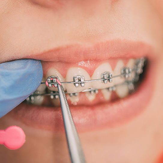Hilgers Orthodontics -