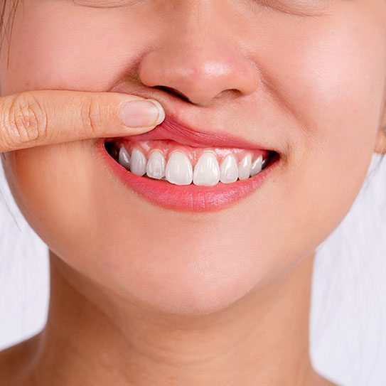 Hilgers Orthodontics -