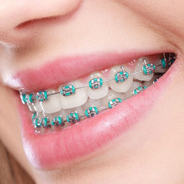 Hilgers Orthodontics -