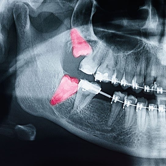Hilgers Orthodontics - Dr. Hilgers -