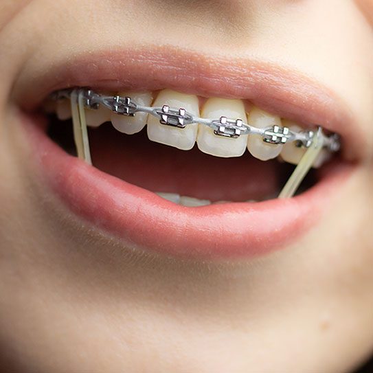 Hilgers Orthodontics -
