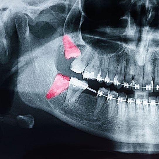 Hilgers Orthodontics -