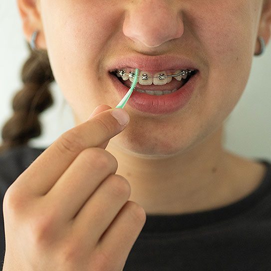 Hilgers Orthodontics -