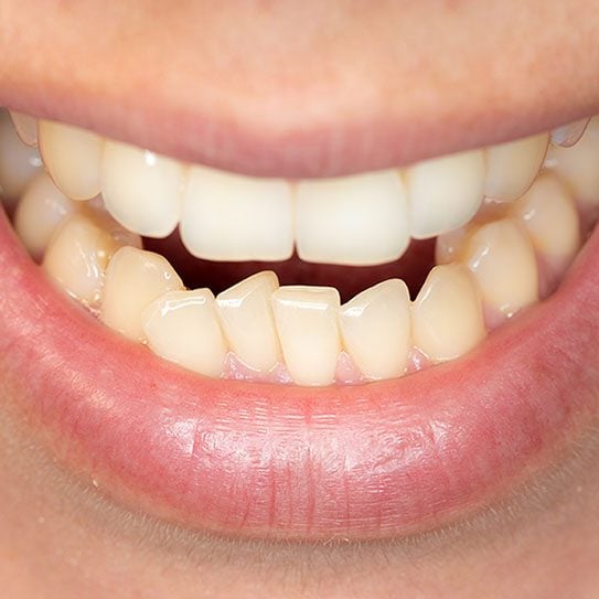 Hilgers Orthodontics -